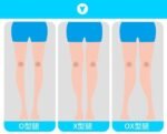 Correcteur de Jambes X et O haute qualité pour enfants – Image 3